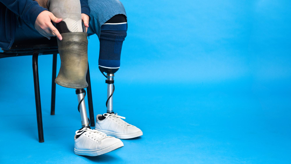 prosthetic centre