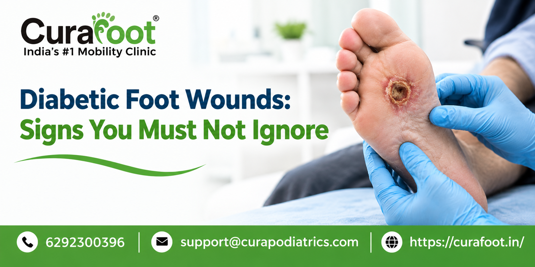 diabetic foot wound treatment